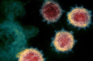 新型コロナウイルスに後遺症、日本でも感染者から報告多数！回復者の3割で後遺症の恐れ　イタリア呼吸器学会