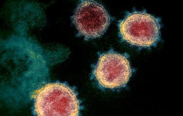 新型コロナウイルスの死亡率、インフルエンザの3倍高いとの研究結果　集中治療の期間もインフルの平均2倍　